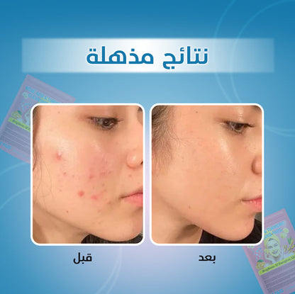 TURMERIC & KOJIC ACID PADS