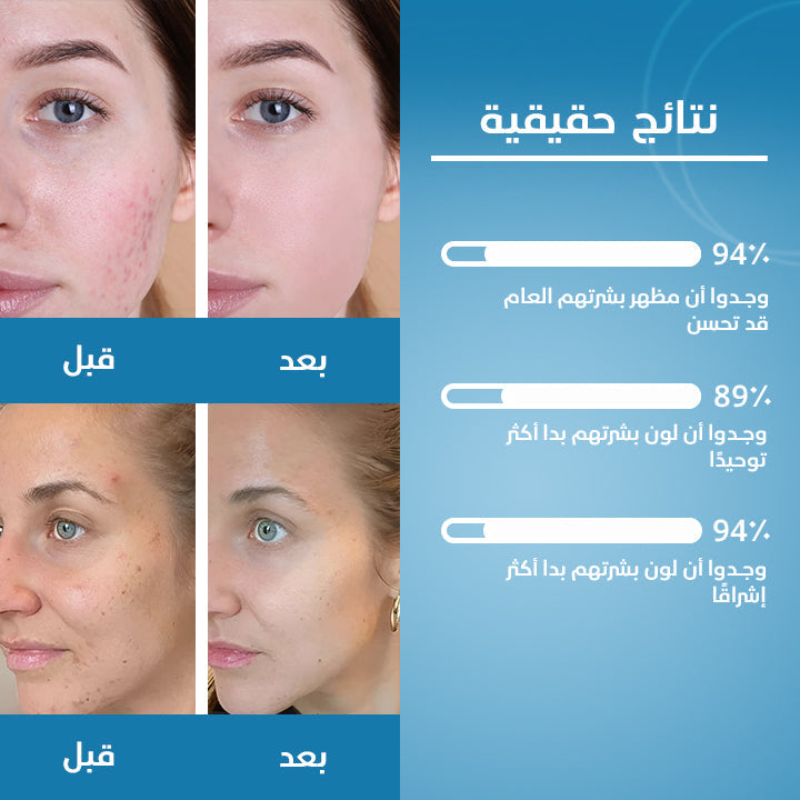 TURMERIC & KOJIC ACID PADS