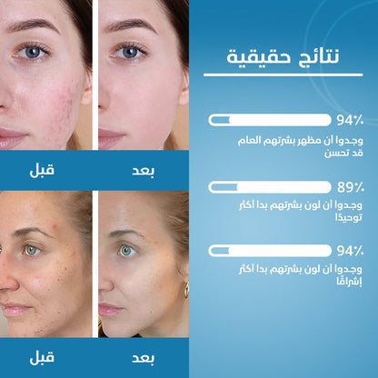 TURMERIC & KOJIC ACID PADS